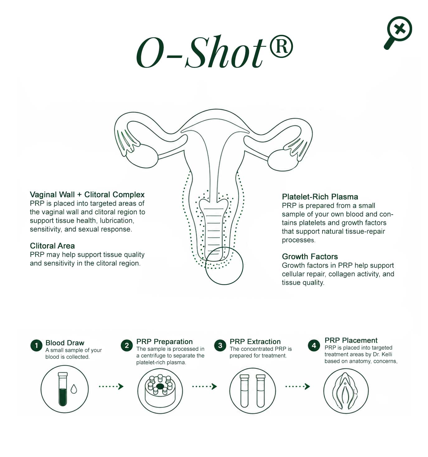 O-Shot+1